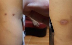 Sức khỏe bé trai tố bị bố cùng mẹ kế bạo hành giờ ra sao?