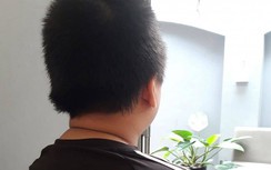 Kết quả giám định thương tích bé trai nghi bị bố và mẹ kế bạo hành