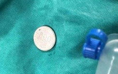 Hai cách xử trí khi con hóc dị vật đơn giản mà có thể tránh nguy cơ tử vong