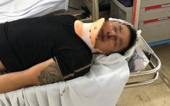 Khởi tố, bắt giữ nhân viên địa ốc Alibaba đánh khách hàng