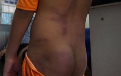 Xác minh việc 4 em học sinh tiểu học ở Cà Mau nghi bị bạo hành