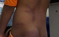 Chủ tịch Cà Mau chỉ đạo “nóng” vụ 4 học sinh bị người thân bạo hành