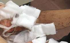 Truy tìm hung thủ nhả đạn phá hủy ô tô khiến một người trọng thương