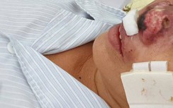 Kinh hãi căn bệnh "ăn thịt người" tái xuất, 4 người tử vong