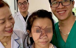 Niềm vui có “gương mặt mới” từ phẫu thuật miễn phí