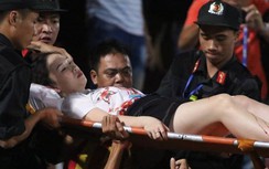 Nữ cổ động viên bị thương do pháo sáng phải nằm viện dài ngày, chờ ghép da