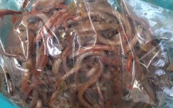 Kinh hãi trẻ 11 tuổi tắc ruột vì búi giun cả trăm con