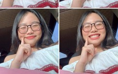 Thủy đậu lây lan khắp mặt, Phương Mỹ Chi phải hủy show