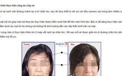 Nữ bệnh nhân tử vong sau khi căng da mặt: Bộ Y tế nói gì?