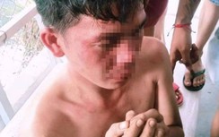 Tình tiết bất ngờ vụ cha đánh con, cộng đồng mạng kéo đến nhà trả thù