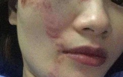 Lãnh đạo công ty xe buýt nói gì vụ nữ nhân viên bán vé bị đánh bầm dập?