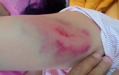 Mâu thuẫn cá nhân, chánh văn phòng huyện ủy đánh lái xe nhập viện