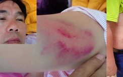 Chánh văn phòng Huyện ủy đánh lái xe nhập viện nói gì?