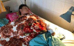 Ghép nối thành công bàn tay thanh niên bị chém đứt lìa sau cuộc nhậu