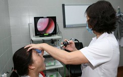 Đừng chủ quan với những cơn đau đầu do viêm xoang