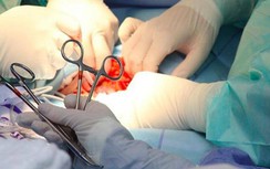 Người đàn ông 36 tuổi tự tay cắt cụt "của quý" nhưng khai do... chó cắn