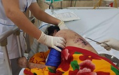 Nữ nhân viên bị chủ quán hành hạ vì không tiếp khách kích dục hiện ra sao?