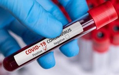 Thổ Nhĩ Kỳ thực hiện phương pháp mới để chữa bệnh cho người nhiễm Covid-19