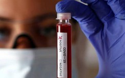 TP.HCM: Lấy mẫu xét nghiệm gần 1.500 hành khách đến sân bay, nhà ga