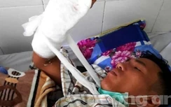 Tỉnh Kon Tum chỉ đạo khẩn trương điều tra vụ chém bảo vệ rừng