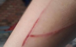 Bé gái bị hại 15 tuổi trong vụ án hiếp dâm bị người lạ chém ở TP.HCM