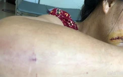 Mâu thuẫn, người đàn ông chém người tình lớn tuổi nhập viện