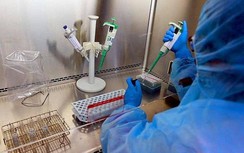 Việt Nam đã làm chủ cả hai phương pháp xét nghiệm Covid-19