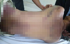 Khởi tố vụ án, khởi tố bị can vụ bị án tử vong trong nhà tạm giữ