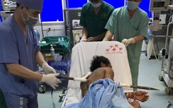 Phút sinh tử cứu người đàn ông bị xà beng đâm xuyên người lúc đào giếng