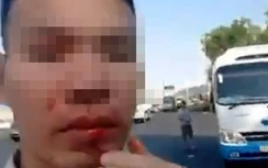 Sự thật tài xế bị đánh chảy máu miệng khi làm việc với liên ngành Đà Nẵng