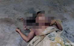 Nam thanh niên tử vong khi vừa sử dụng điện thoại vừa sạc pin