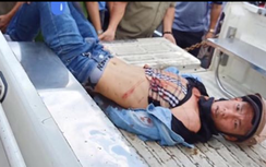 Vây bắt tên trộm xe SH ở TP.HCM, 2 người bị đâm nhập viện