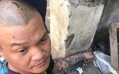 Tạm giữ hình sự nghi phạm bắn ca sỹ Hồ Phàm trọng thương trong đêm