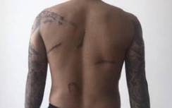 Khởi tố vụ án đàn em Đường "Nhuệ" truy sát nam thanh niên sau 8 năm