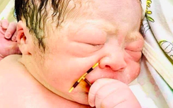 Triệt sản, đặt vòng vẫn sinh con có bất thường?