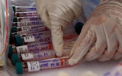 Thêm 41 ca mắc mới Covid-19; Lạng Sơn, Bắc Giang vào “bản đồ” dịch