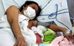 Sức khỏe sản phụ mắc Covid-19 sinh con đêm 15/8 giờ ra sao?