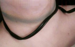 TP.HCM: Người đàn ông bị vợ cũ và con trai siết cổ tử vong sau khi nhậu về