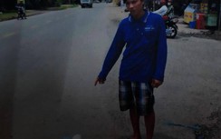 Bị tạt dung dịch có chứa axit, nam thanh niên bỏng 13%