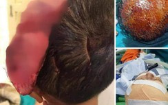 Kinh hãi chó nuôi lâu năm trong nhà bất ngờ tấn công bé trai 5 tuổi