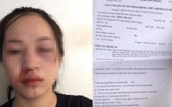 CSGT Chiêm Hóa nói gì về clip bị tố vụt sưng mặt người vi phạm?