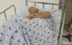 Một người suýt mất mạng vì bị chém vào hộp sọ