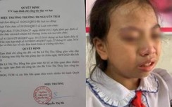 Đình chỉ cô giáo tát vào má học sinh ở Hà Giang