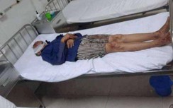 Đi ăn đám giỗ về, con rể dùng rựa chém cha vợ và anh vợ trọng thương