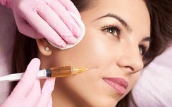 Thêm nữ bệnh nhân sưng biến dạng mặt sau tiêm filler làm đầy mũi, má