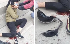 Trả “học phí” bằng máu vì mũ bảo hiểm “rởm”