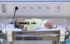 Trẻ 16 ngày tuổi nhiễm virus RSV đến nguy kịch vì nụ hôn của người lớn?