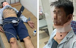 Cảnh sát điều tra vụ tài xế ô tô bị đánh hội đồng sau va chạm giao thông