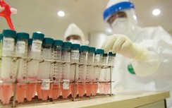 Hà Nội: 2 trường hợp F1 của bệnh nhân tái nhiễm Covid-19 đều âm tính