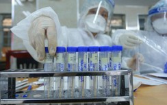 Covid-19 ngày 14/2: Thông báo khẩn về bệnh nhân Covid-19 người Nhật Bản